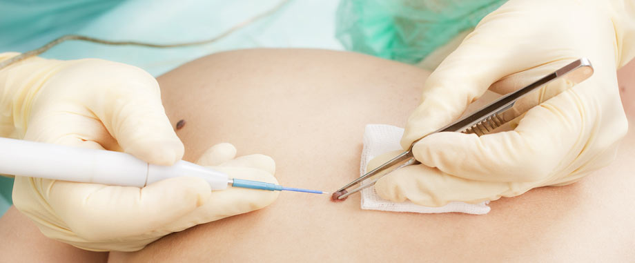 Visite specialistiche della pelle dallo studio Garcovich a Bari